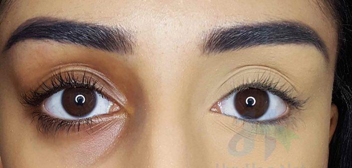 How To Cover Dark Under Eye Circles