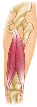 Hamstring muscles on the back of the thigh.