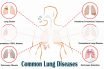 Common dangerous lung diseases