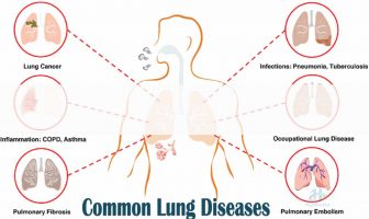 Common dangerous lung diseases