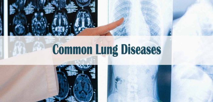 15 Common Dangerous Lung Diseases