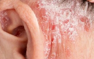 Rash Behind Ear: Causes, Symptoms & Treatments [With Photos]