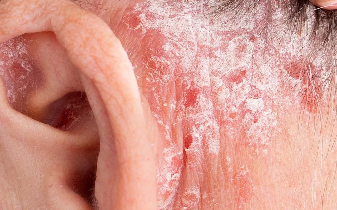 rash behind the ear