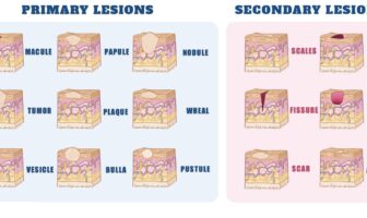 Types of Skin Lesions