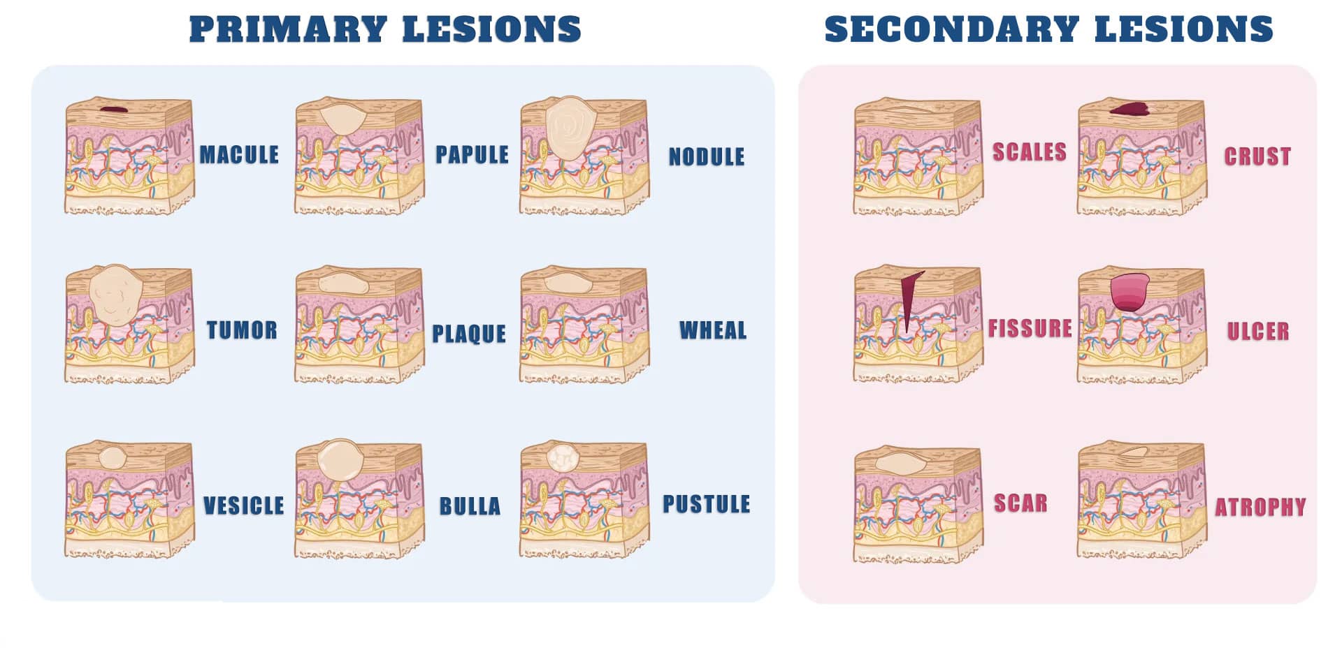 skin lesions chart