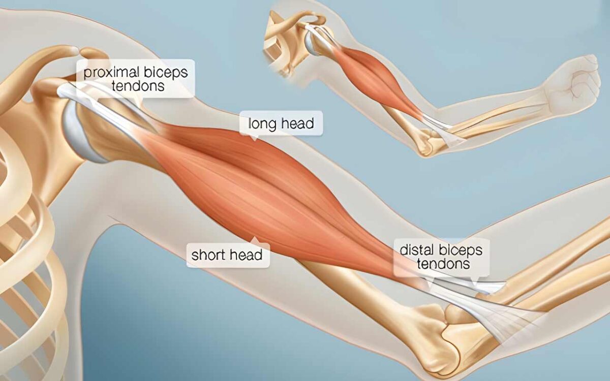 Overcoming The Challenges Of Bad Bicep Genetics: A Comprehensive Guide ...